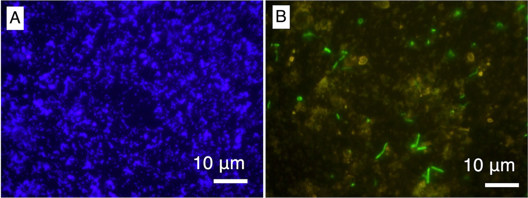 Colonizzazione microbica esistente nelle vene riempite di minerali in rocce ignee di 2 miliardi di anni fa del complesso igneo del Bushveld, Sudafrica. (A) Immagini con ingrandimento di 1000 volte di microsfere fluorescenti e (B) cellule microbiche colorate con Sybr Green. Crediti: Microbial Ecology