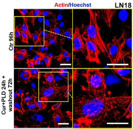 Effetti in presenza o meno del pretrattamento con curcumina e polidatina sulle cellule tumorali di glioblastioma trattate con temozolomide