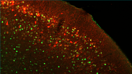 I neuroni della corteccia entorinale laterale che si attivano al richiamo della memoria episodica sono colorati in rosso, in verde i nuclei degli altri neuroni